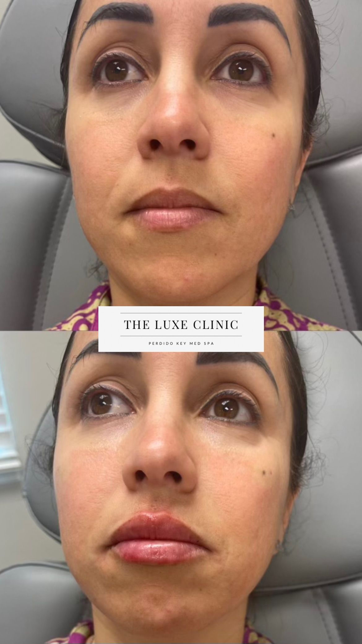 A before and after photo of a woman 's face.