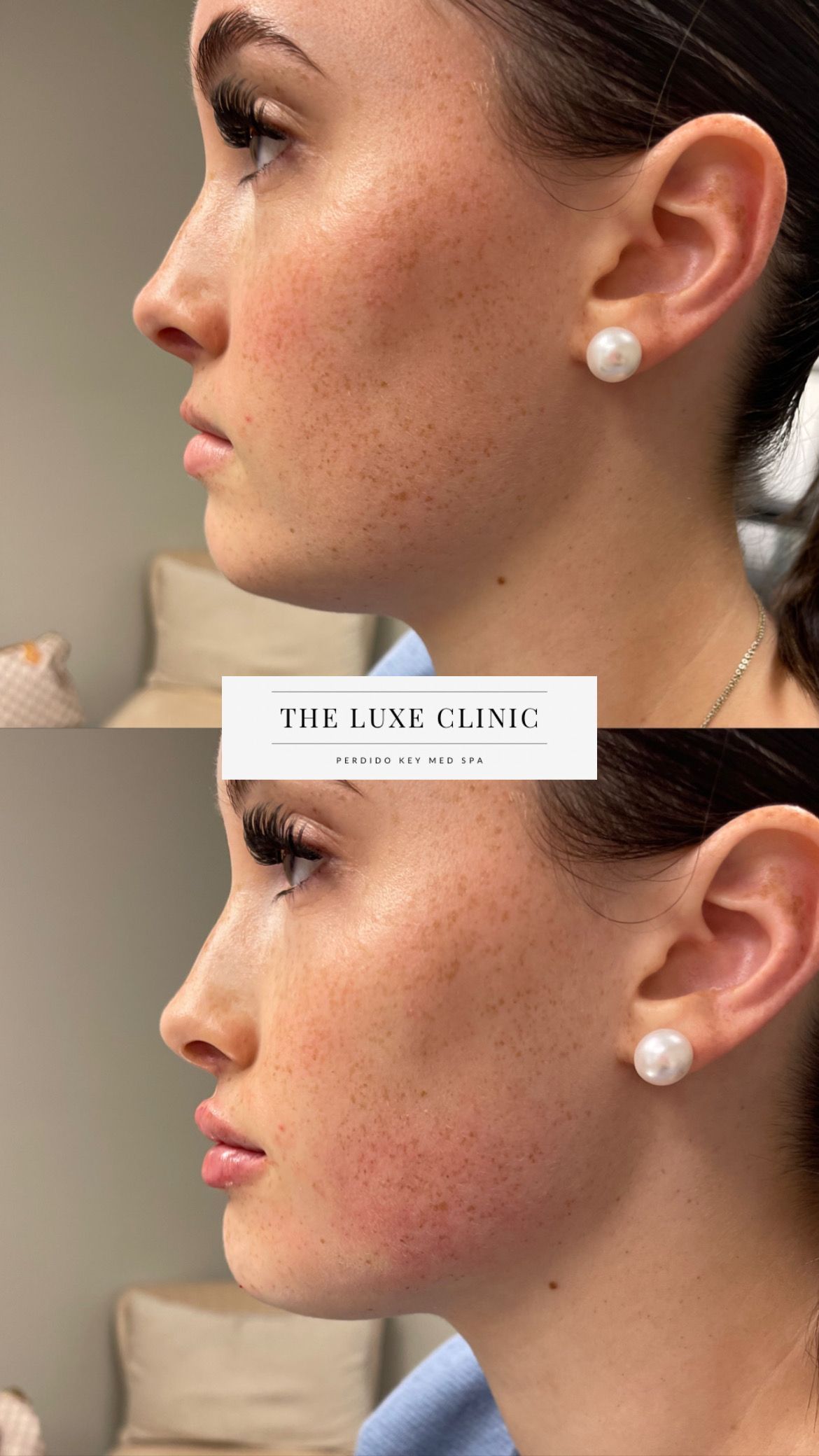 A before and after photo of a woman 's face.