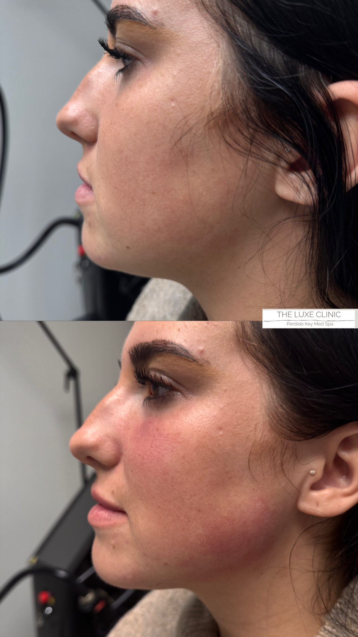 A before and after photo of a woman 's face.