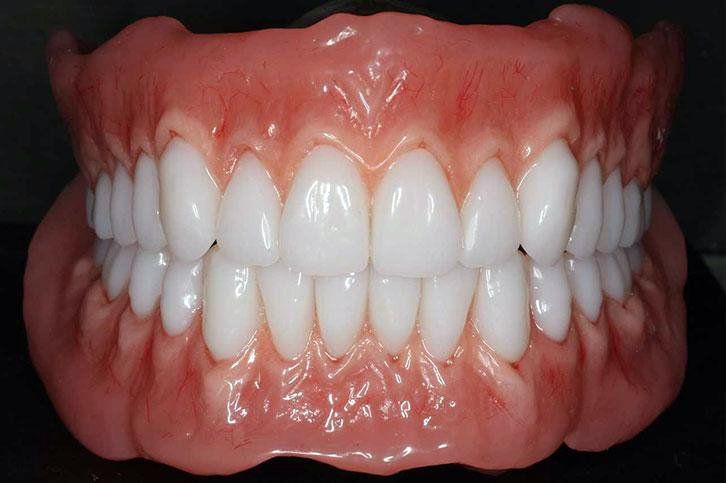 A close up of a denture with white teeth