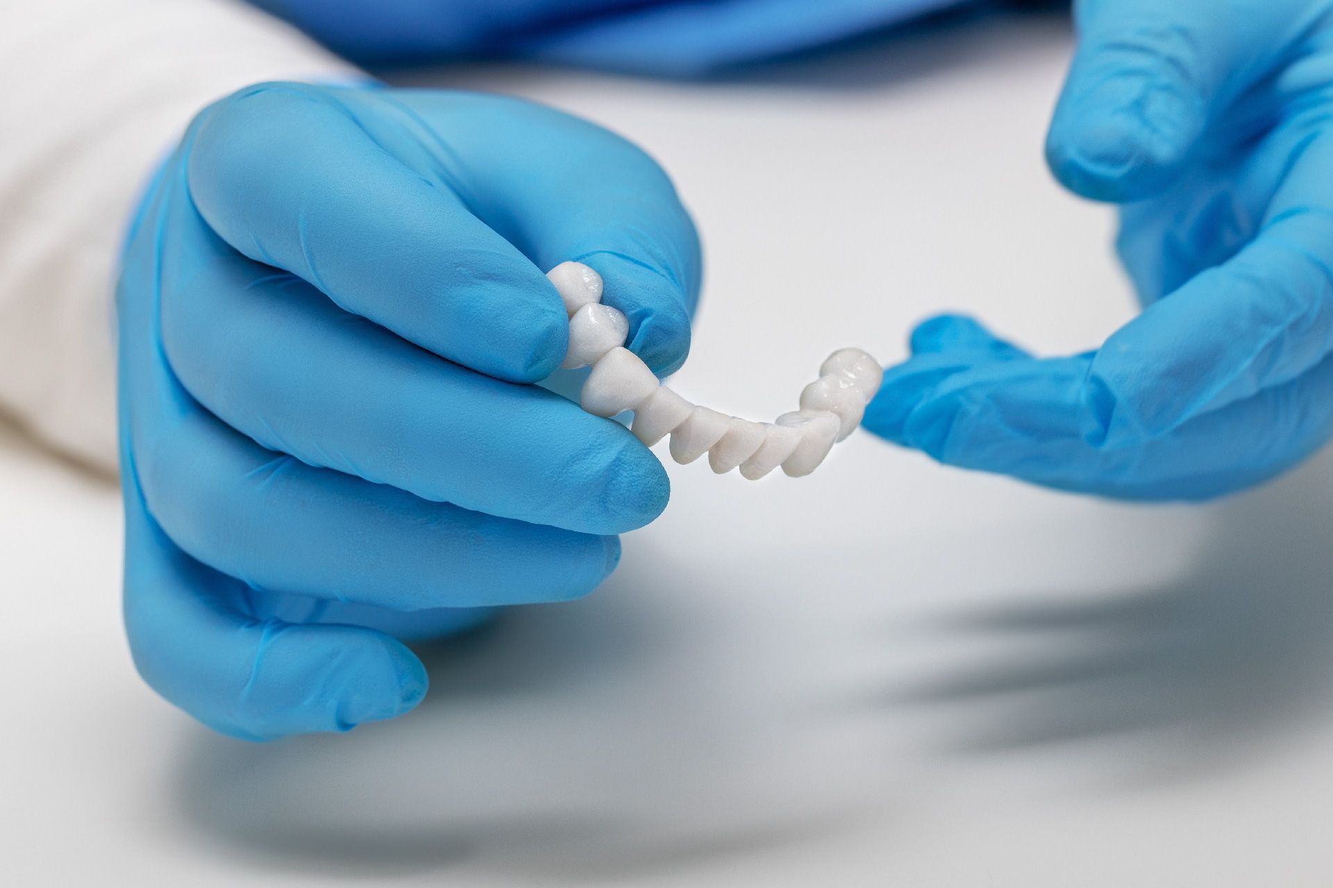 Manos con guantes azules sosteniendo una carilla dental, fondo blanco.