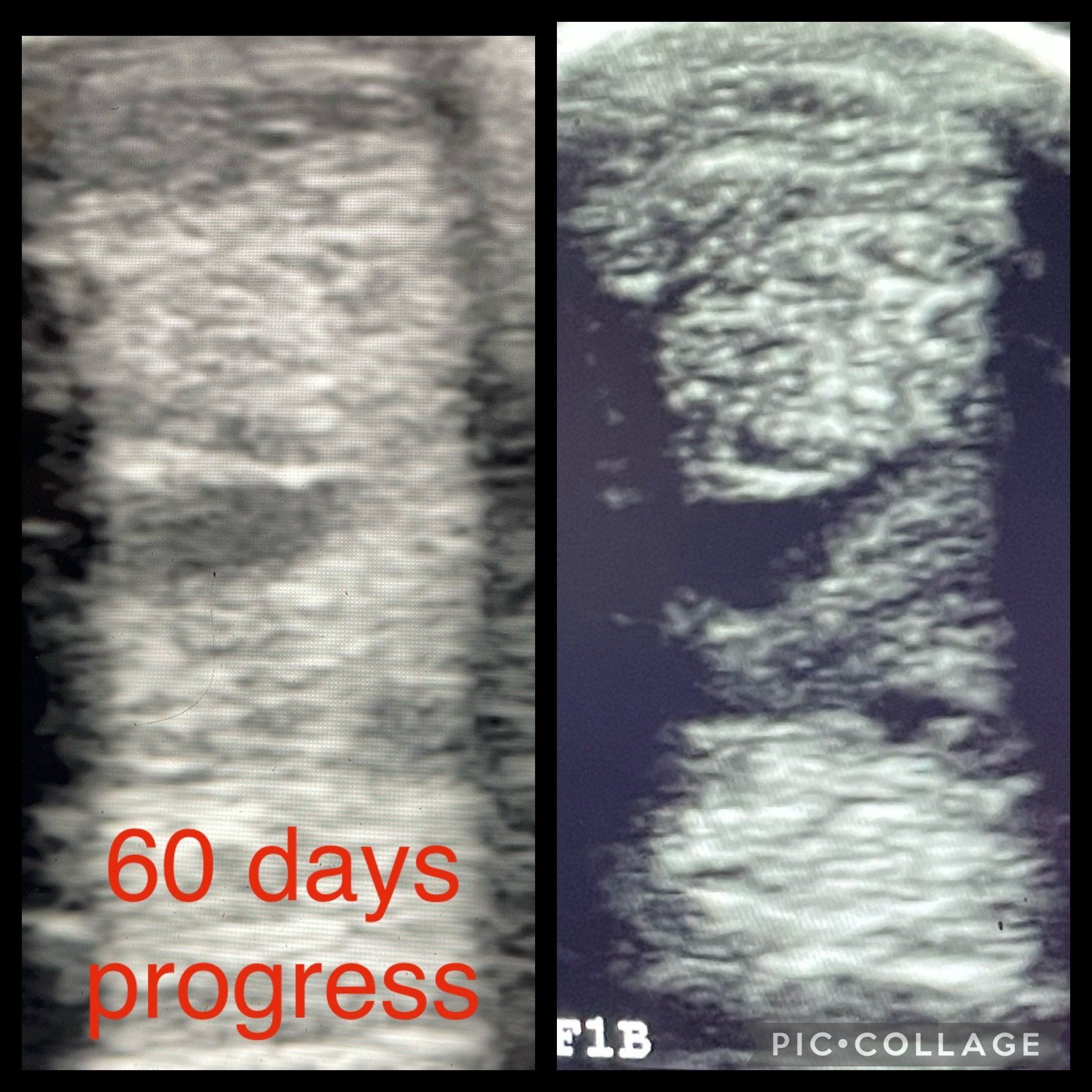 Two ultrasound images of a baby with the words 60 days progress on the bottom