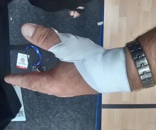 Hånd med tommelfinger pakket ind i hvid tape, iført et sølvur.