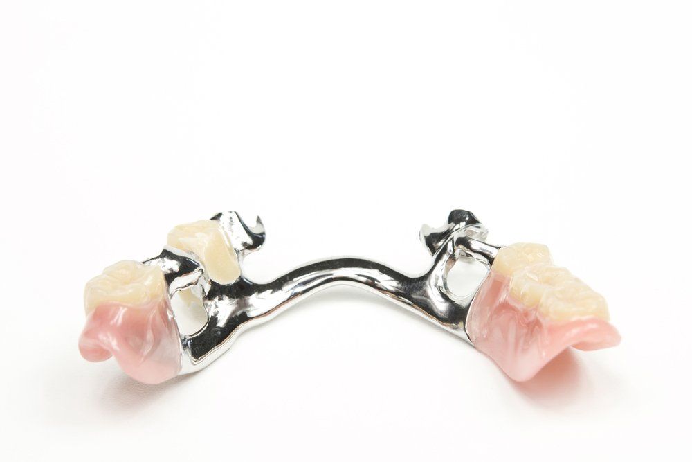 Deture Repairs and Relines