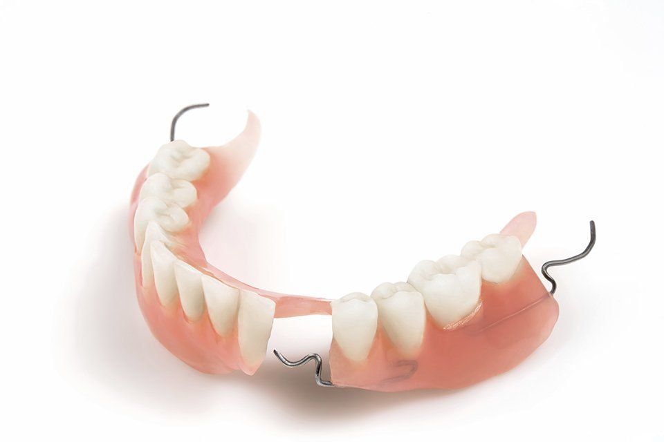 Partial Dentures