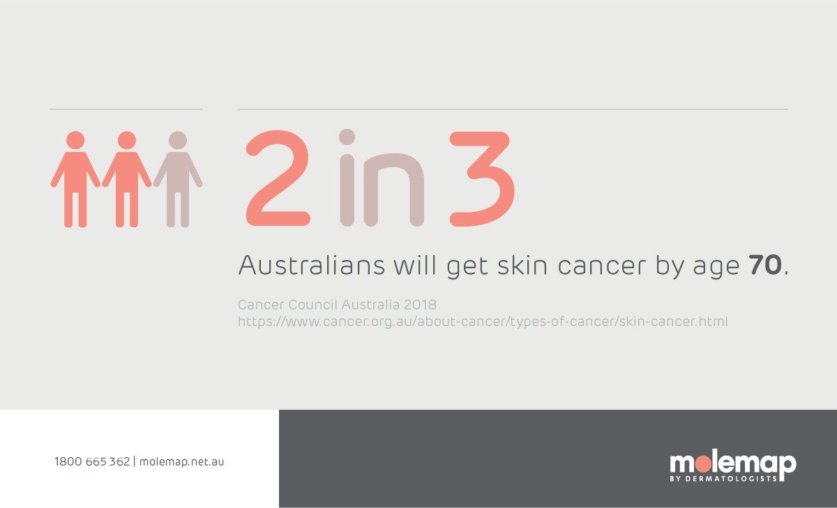 Skin cancer infographic