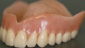 Orthodontic - Bedfordshire - Castle Dental Laboratory - prosthetic_False-Teeth-IS