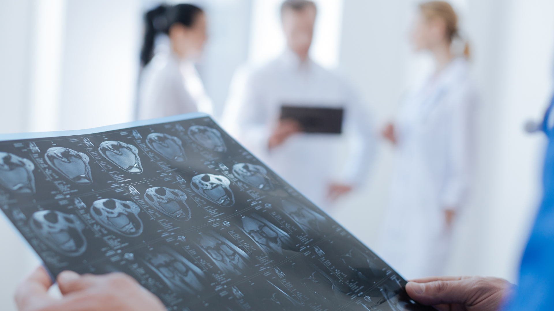 A doctor is looking at an x-ray of a patient 's brain.