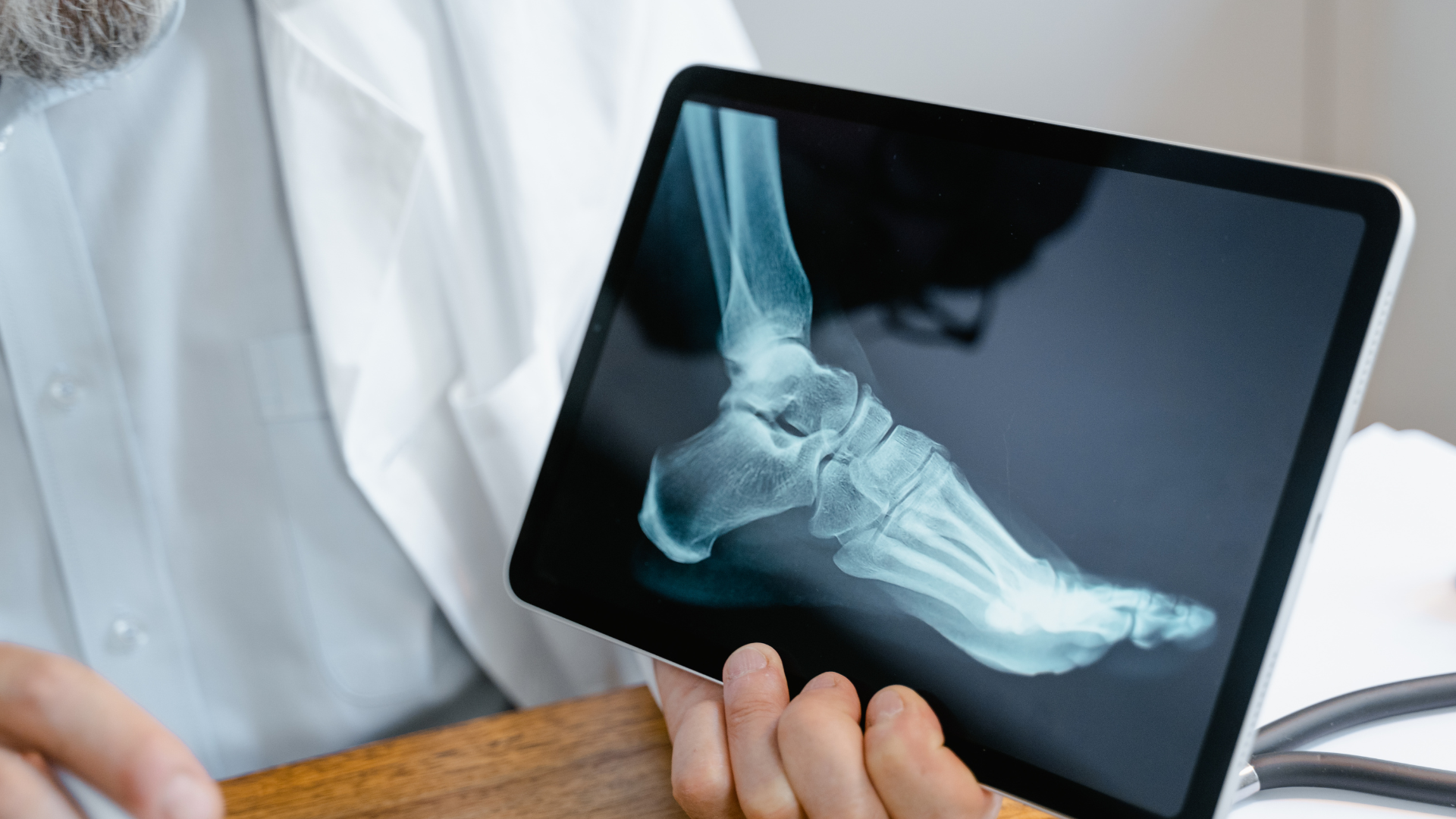 A doctor is holding a tablet with an x-ray of a foot on it.
