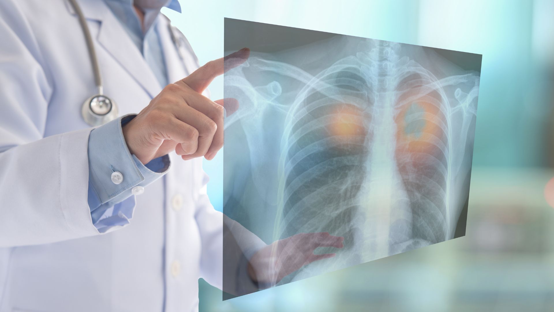 A doctor is holding an x-ray of a patient 's lungs.