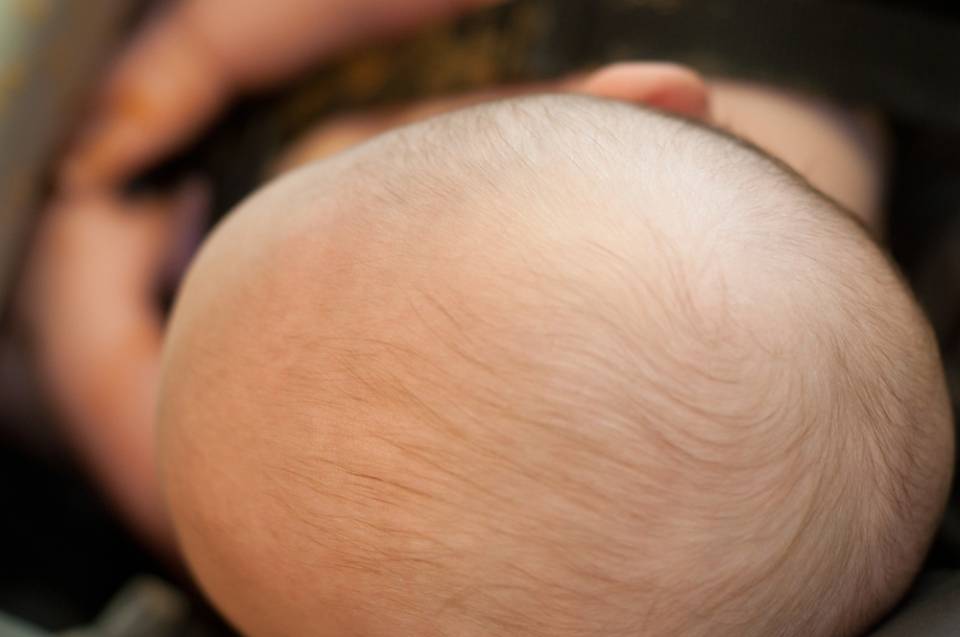 Cranio simmetrico di neonato
