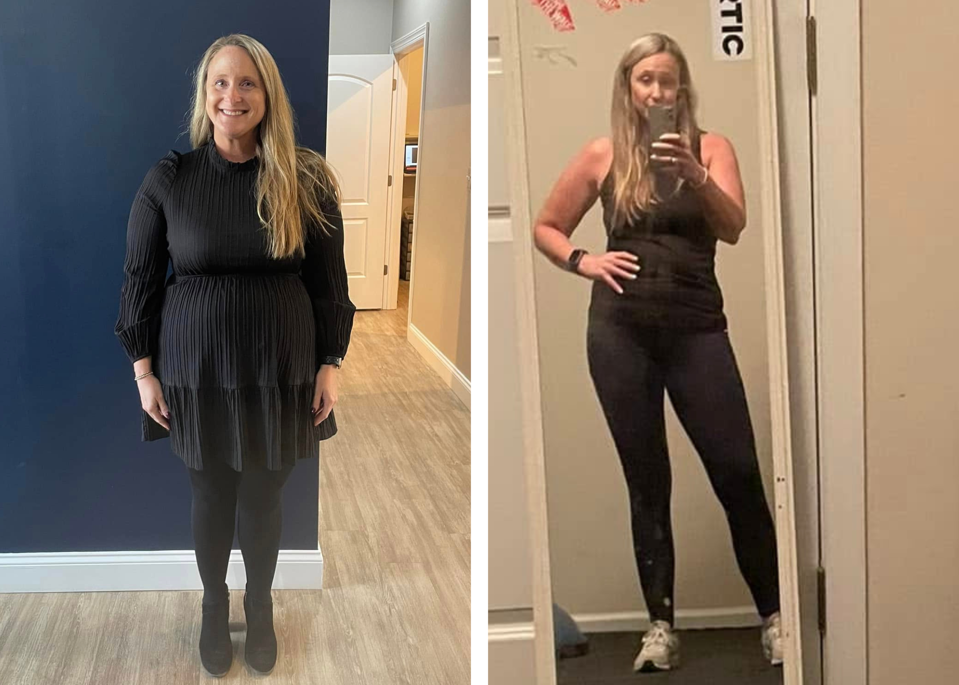 A weight loss before and after photo of a woman standing in a hallway