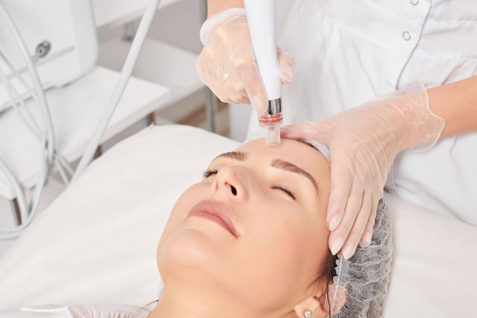 woman getting facial microneedling