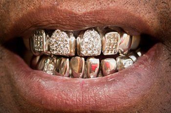 Gold Grills