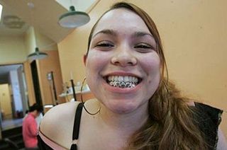 girl showing teeth