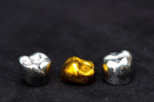 Dental Gold and Silver Crowns