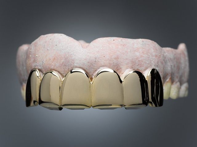 A Brief History of Grills and Other Teeth Jewels