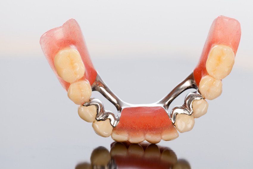 Denture repairs