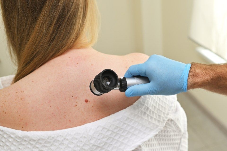 A dermatologist oncologist uses a dermatoscope to examine moles