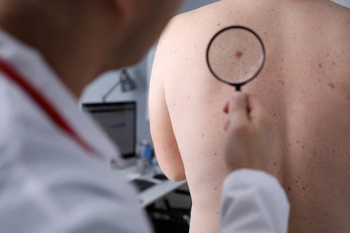 Doctor look at magnifying glass on patient skin