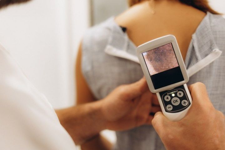 Macro photo of dermatologist is using dermatoscope for facial skin examination.