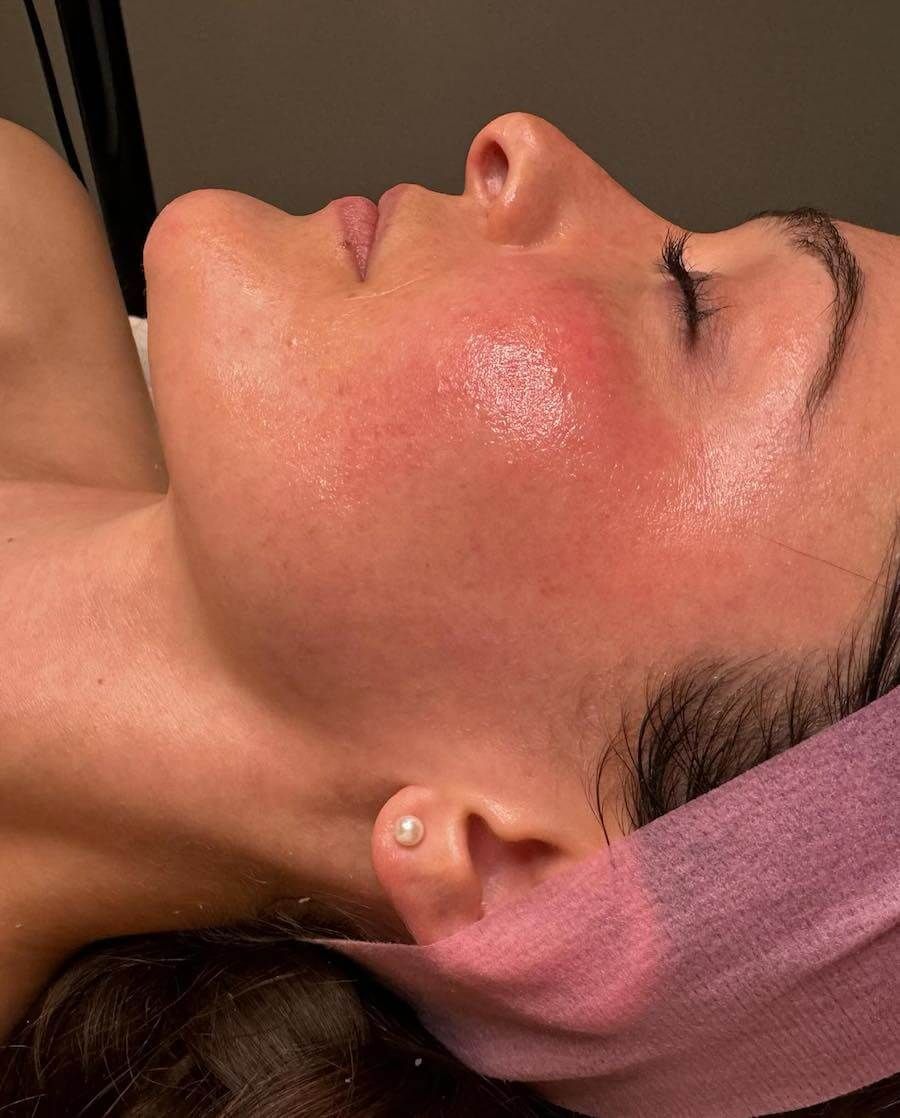 DermaGlow Rapid Renewal