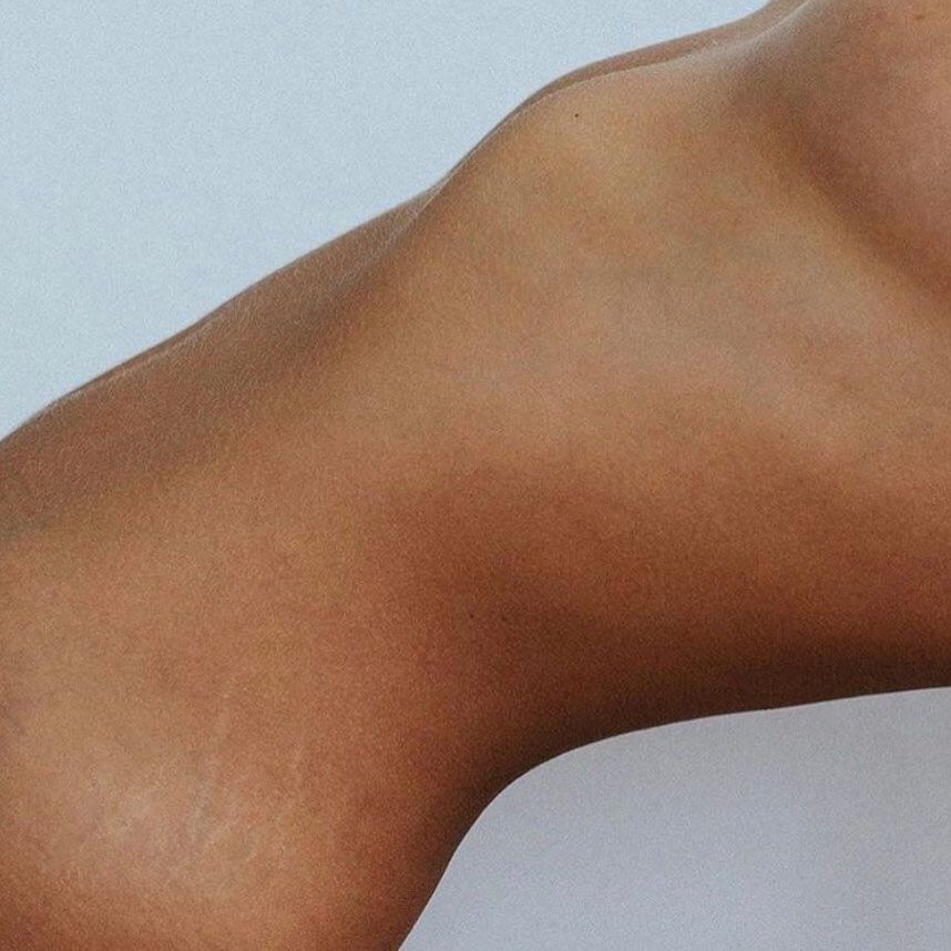 laser hair removal Full Body