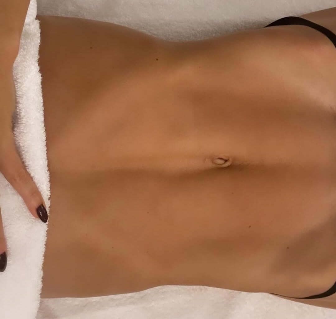 laser hair removal Belly Button