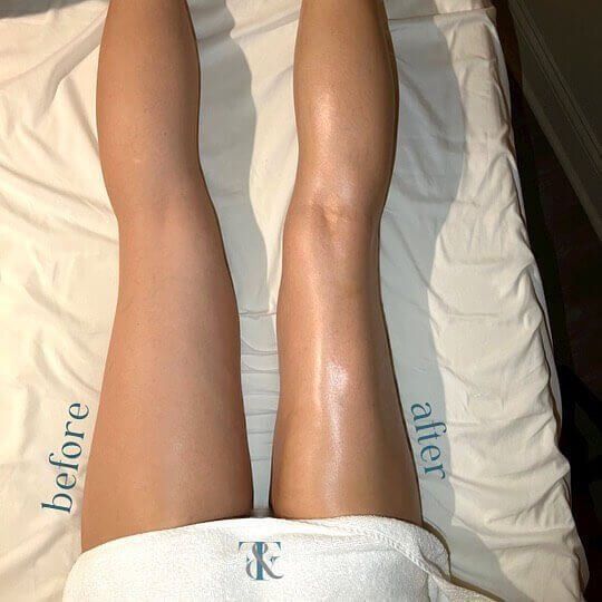 Brazilian Lymphatic Drainage Massage Chicago