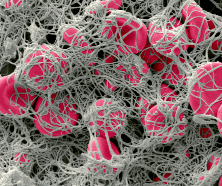 Coagulation Disorders | Service Page | LA Cancer Network