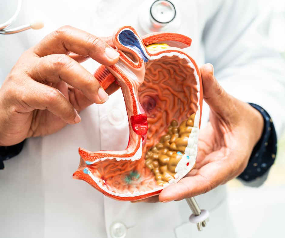 Colorectal Cancer | Service Page | LA Cancer Network