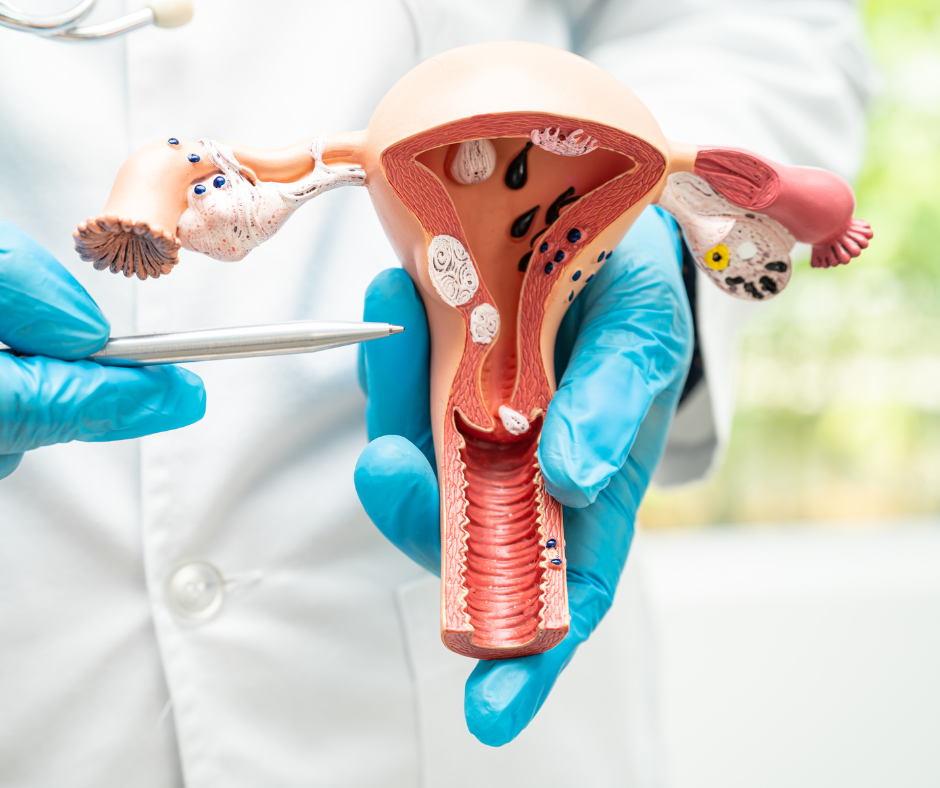 Gynecologic Cancer | Service Page | LA Cancer Network