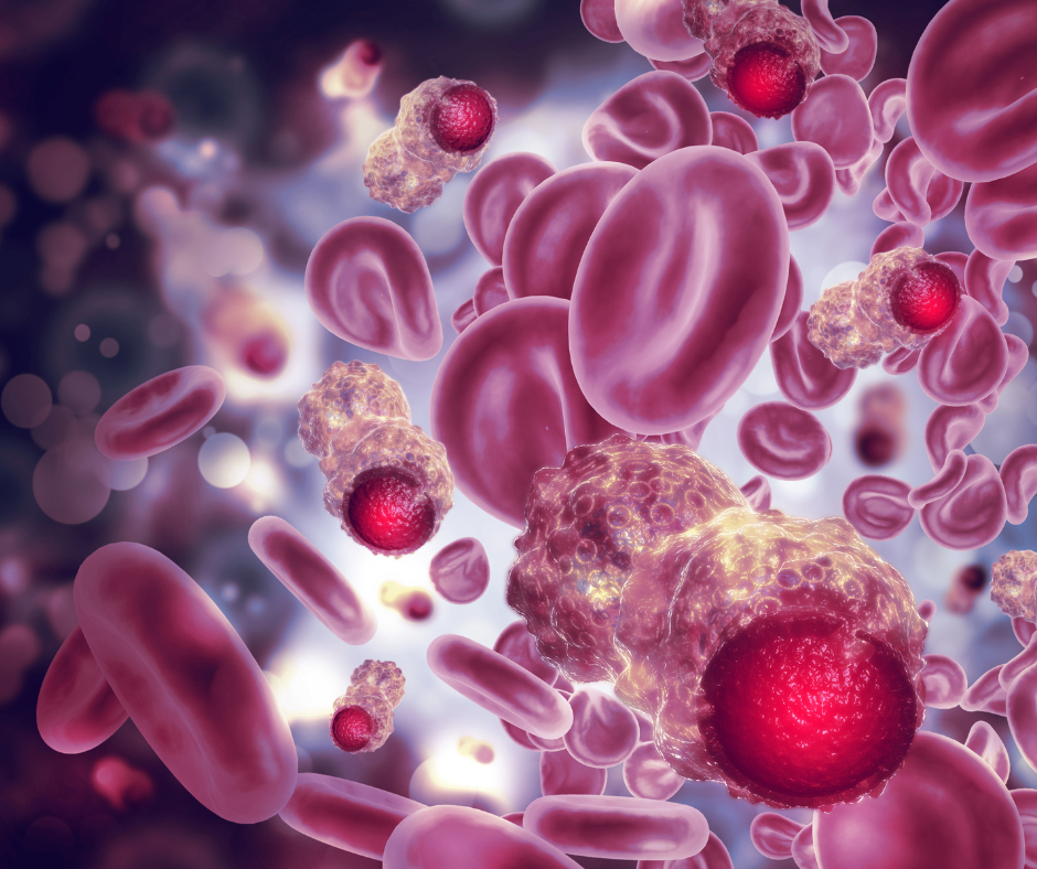 Myelodysplastic Syndromes | Service Page | LA Cancer Network