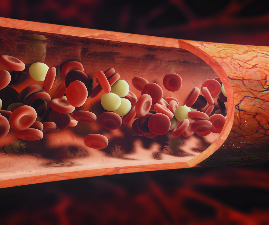 Myeloma | Service Page | LA Cancer Network