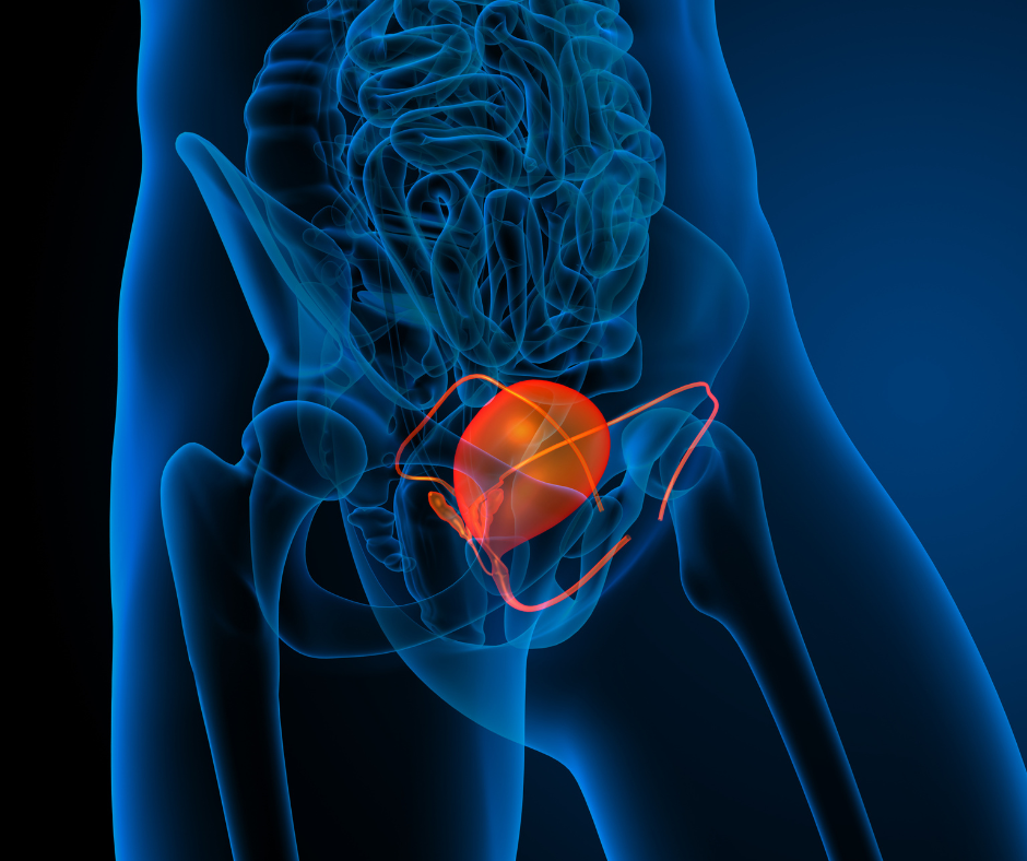Bladder Cancer | Service Page | LA Cancer Network