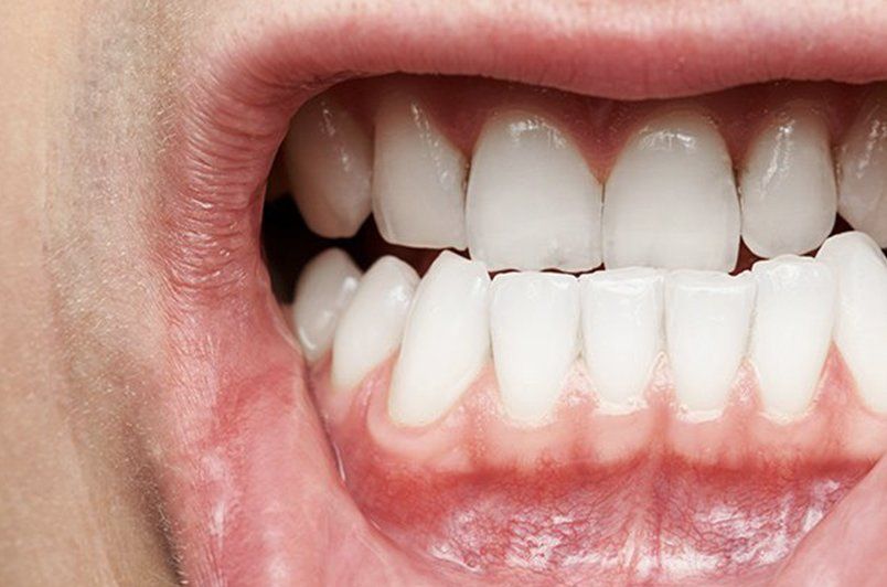 A close up of a person 's mouth with white teeth.