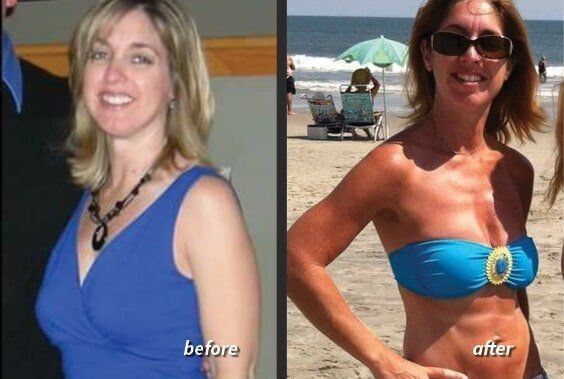 A before and after photo of a woman wearing a blue bikini