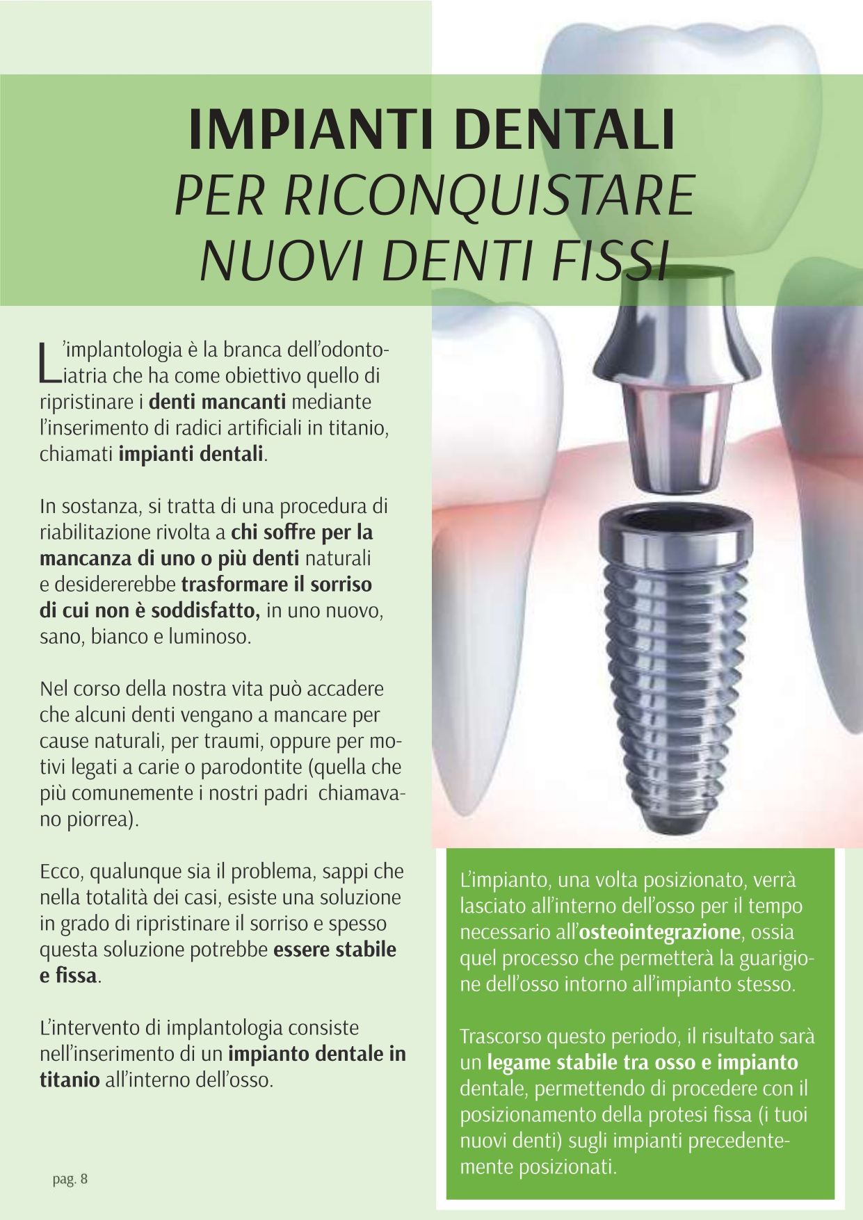 Un poster con l'immagine di un impianto dentale su un dente.