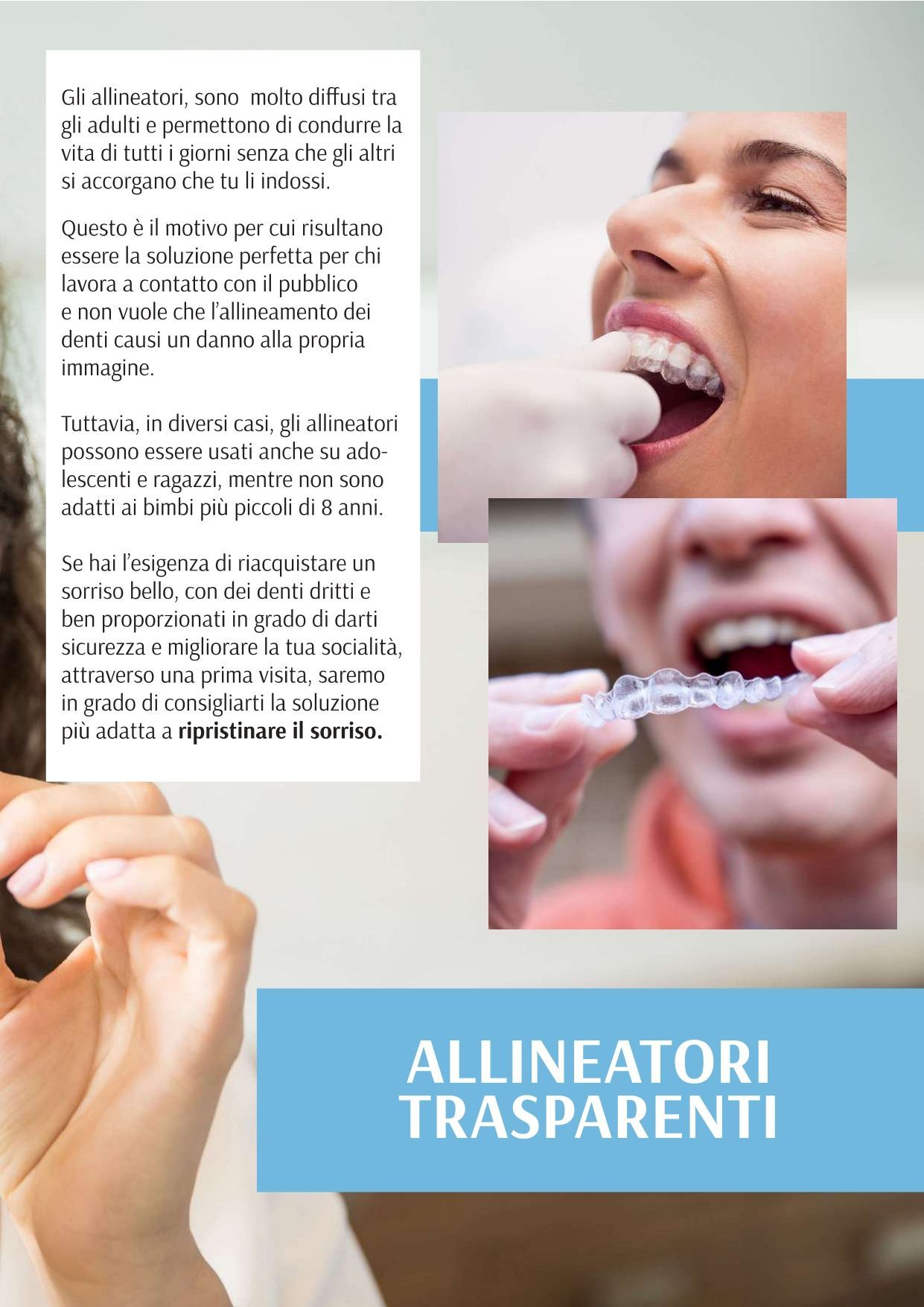 Una donna tiene in bocca un apparecchio ortodontico trasparente.