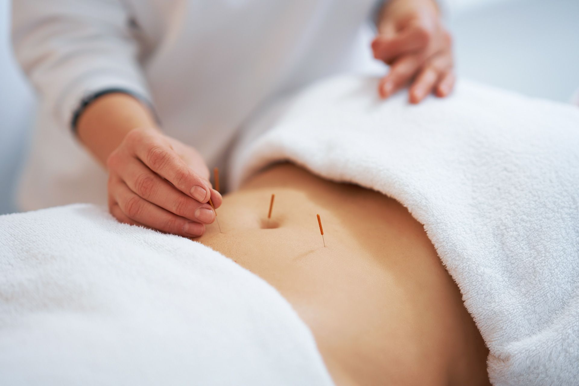 A woman is getting acupuncture on her stomach.