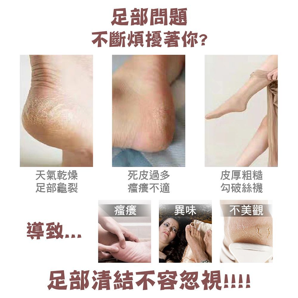 【 預購 磨腳石-1入  】【逆齡完美裸足！雙面除皮磨腳石】 刮腳皮 搓腳石 搓腳板 磨腳器 腳跟死皮 除老繭 磨腳工具 火山石 沐浴石 美足【DE818】