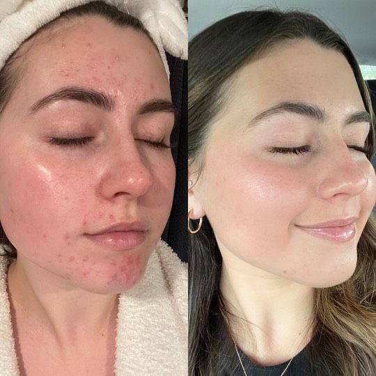 Skin Care