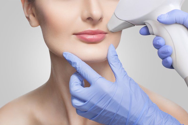 Removing Unwanted Hair Around the Mouth — Houston, TX — Continental Electrolysis & Laser Clinic