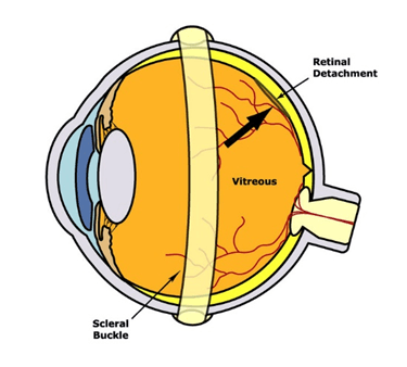 Hilton Head Retina Institute | Macular Degeneration | Dr. Carl Baker