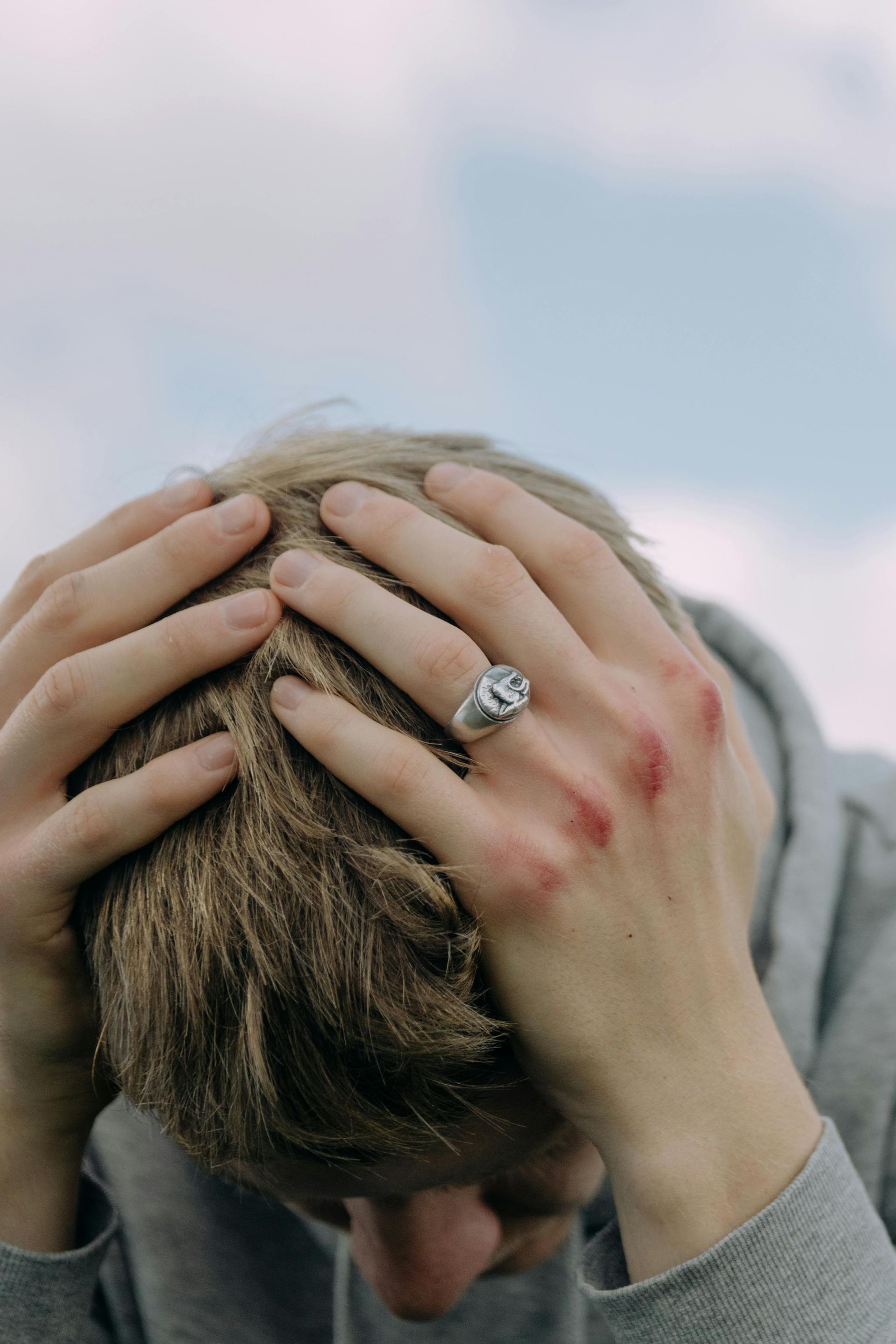 A man with a ring on his finger is holding his head.