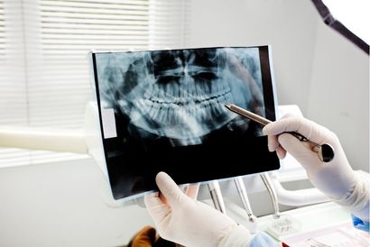 Dentist pointing at dental X-ray of teeth. Hands wearing gloves. Setting is a dental office.