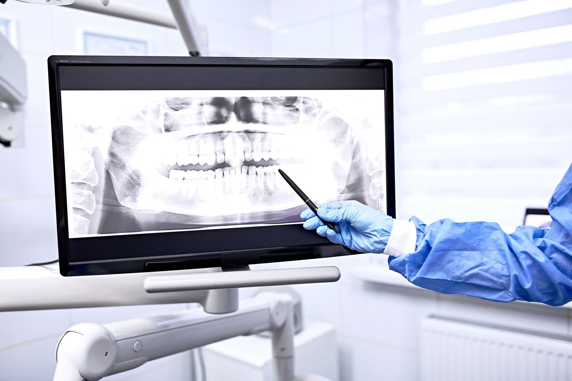Dentist pointing at dental X-ray on a monitor. Surgical gloves, blue gown, in a dental office.