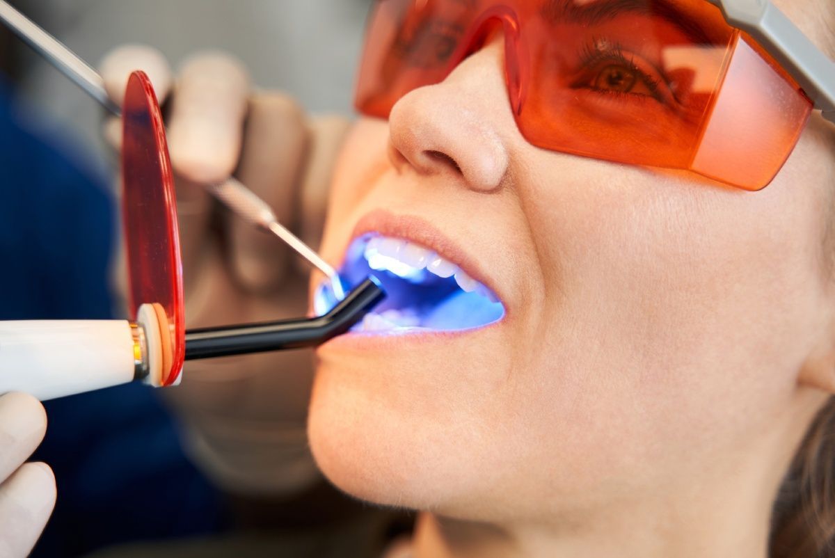 Dentist using blue light on patient's teeth during a filling procedure.