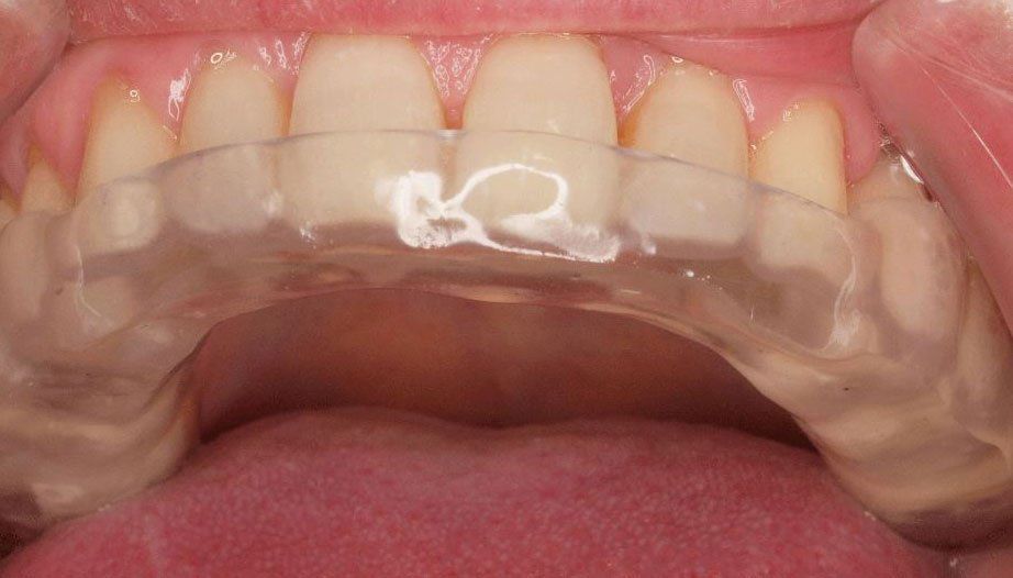 Consultorio y Laboratorio Dental San Pablo dientes