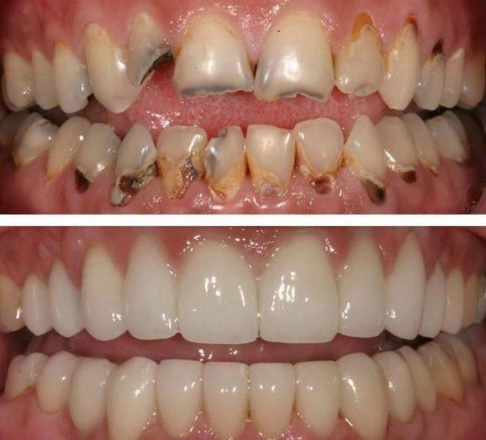 Consultorio y Laboratorio Dental San Pablo antes y después